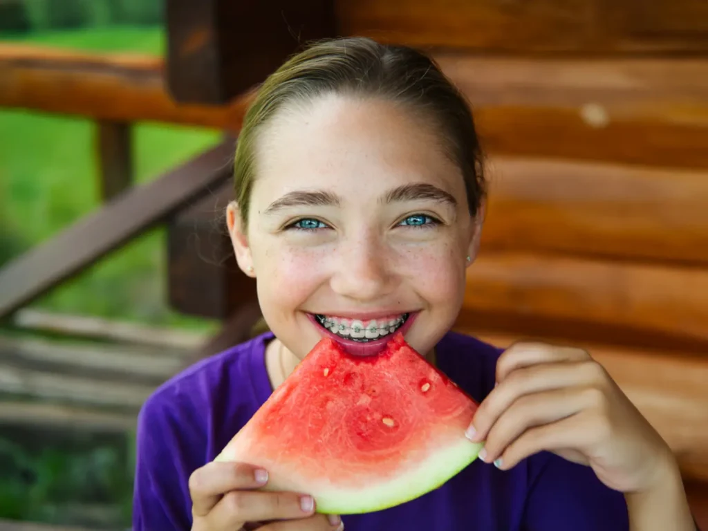 Summer Foods to Eat – And Avoid – With Braces