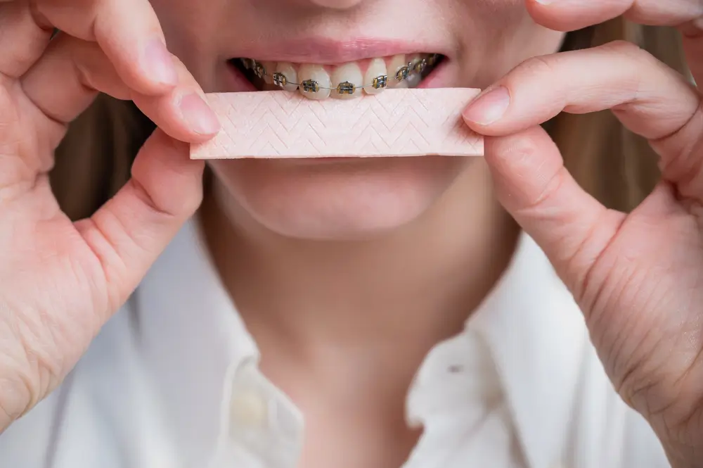 gum-and-braces