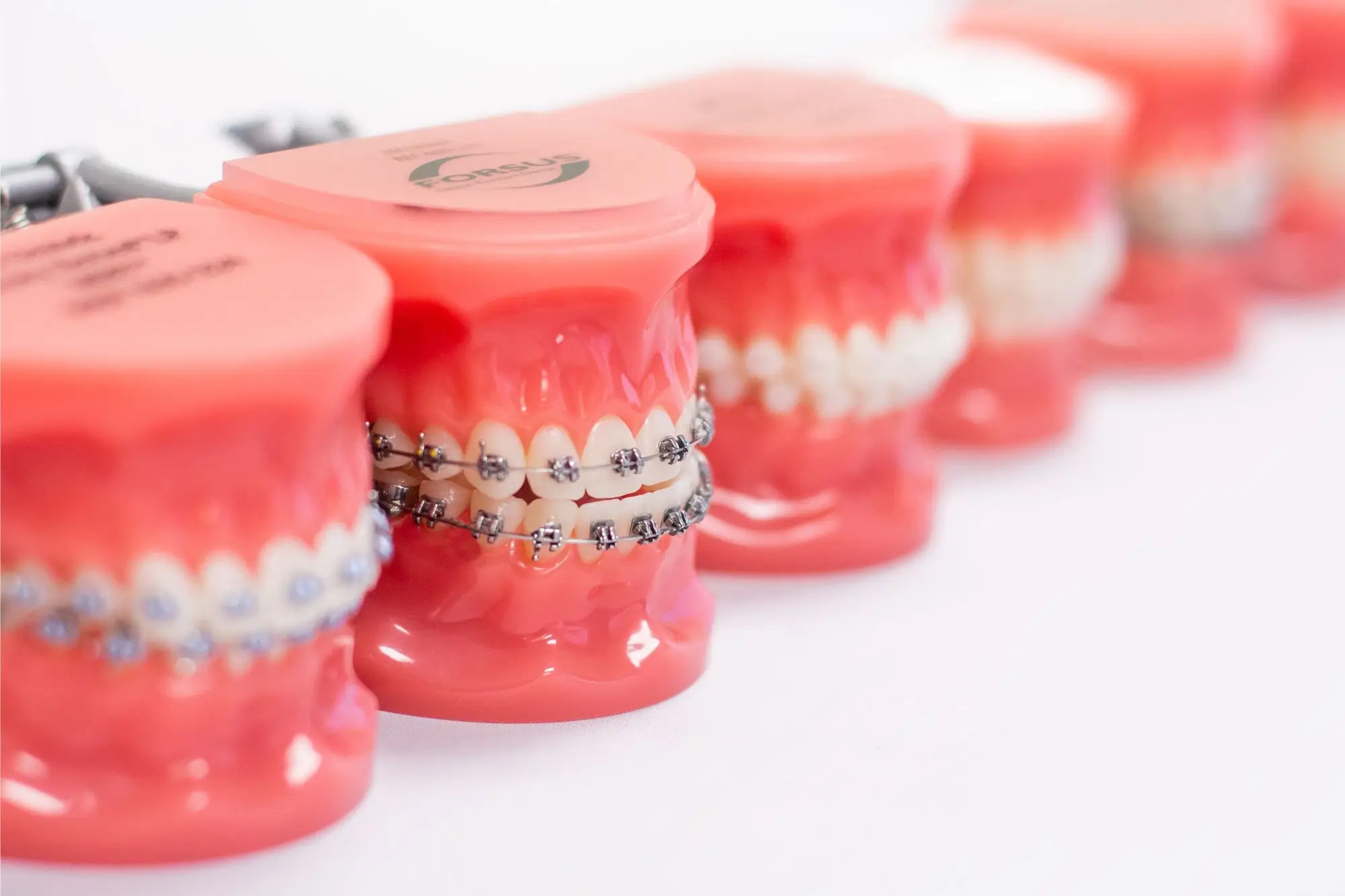 Types of Braces Types of Braces