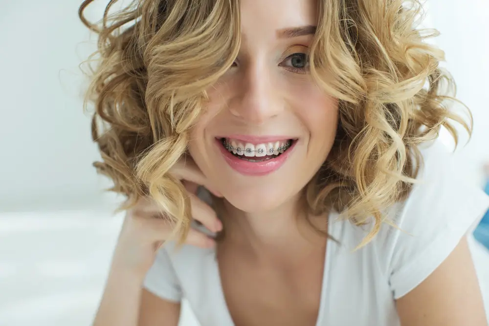 Benefits of Having Straight Teeth Go Beyond Aesthetics