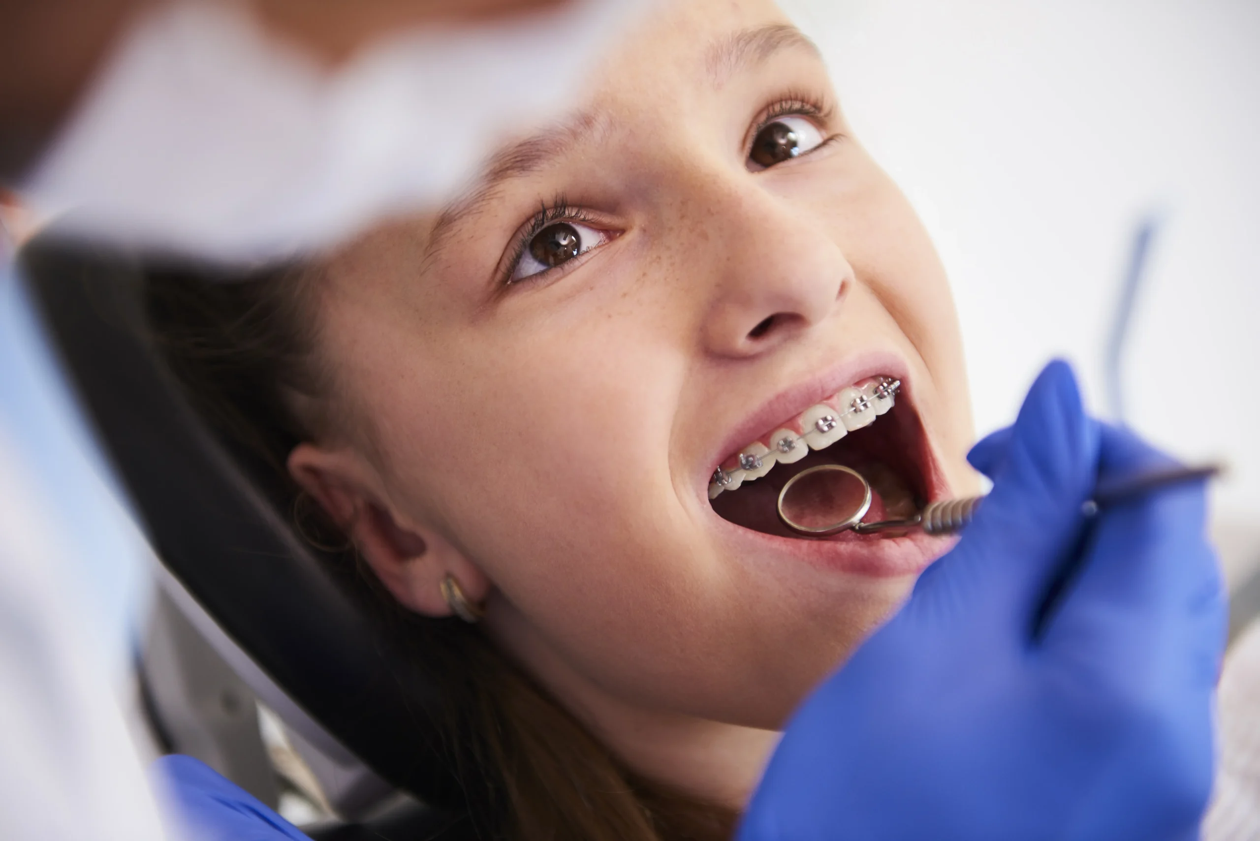 Early Orthodontic Intervention Early Orthodontic Intervention