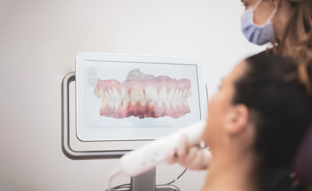 iTero Intraoral Scanner