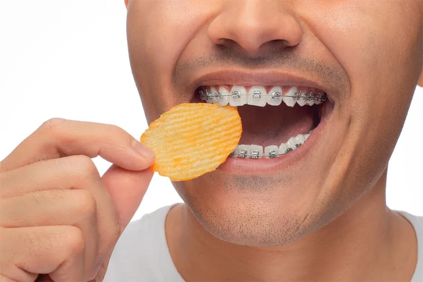 Snack on When You Have Braces