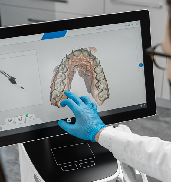 TRIOS Digital Impression Scanning TRIOS Digital Impression Scanning