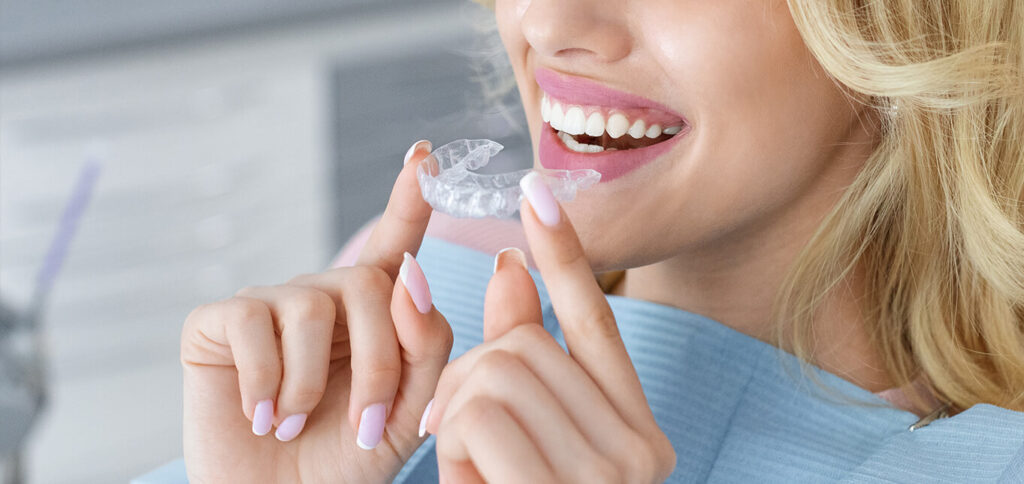 Types of Bites Aligner Trays