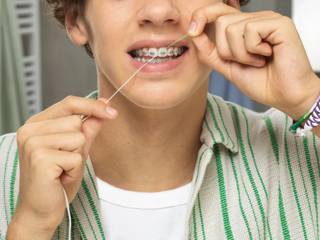 Ways to Make Flossing with Your Braces Easier