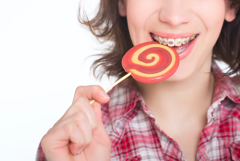 Due to one reason or the other, you might have had some misaligned teeth. However, you made the brave decision to get braces so that you can have the best smile of your life. Although they work slowly, their impact is definite when they come off. Braces have the ability to straighten crooked teeth and give you back the self-confidence you have always wanted. However, the journey of wearing braces is not an easy one. It needs some discipline in seeing the orthodontist and dentist when checkups are due and also being very careful of what you eat. Not all foods are the same. Their consistencies matter and this causes a big difference in how enduring the braces are. If you want to have your braces stay in the best possible shape, it’s crucial that you remain very keen in regards to the different foods you eat. Some foods are quite hard and eating them will only cause the wires on the braces to break, which will mean a trip back into our office for corrections. Foods To Stay Away From Chewing Gum Although gum might have been one of your favorite pastime consumables before you put on your braces, it’s something that would be recommended for someone who has braces on. Although gum doesn’t stick to regular teeth, it is very sticky on the brace wires and can be a problem to try removing it from the braces. Whole Fruits And Veggies what-not-to-eat-with-braces