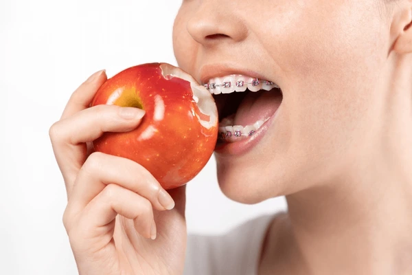 woman-braces-biting